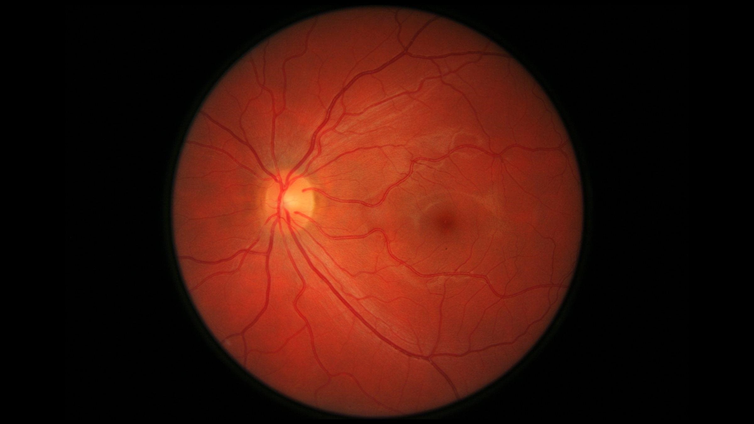 Help build the world’s most advanced retinal imaging database - College ...